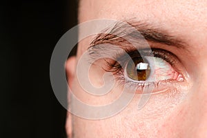 Close up mans bloodshot or red eyes on a black background, caused by conjunctivitis, allergy or tiredness . Concept of