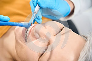 Close-up mature lady smiling visiting aesthetic dentist, airflow tooth cleaning