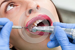 Close-up medical dentist procedure of teeth polish