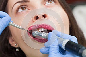 Close-up medical dentist procedure of teeth polish