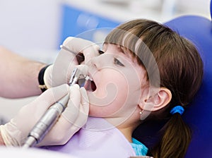 Close-up medical dentist procedure of teeth polish