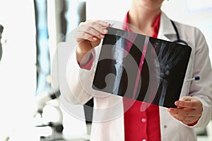 Medical worker analyzing patient hand xray result, injury