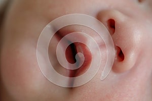 Close up mouth and nose newborn baby sensitive skin