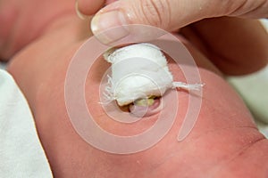 Close up of navel newborn baby boy. Close up umbilical cord .