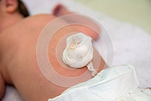 Close up of navel newborn baby boy. Close up umbilical cord. Umbilical cord with bandage