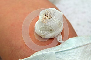 Close up of navel newborn baby boy. Close up umbilical cord. Umbilical cord with bandage