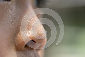 Close up nose of a child, sweat on nose