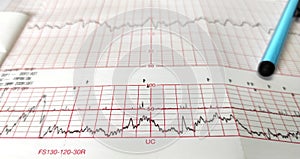 Close up NST paper, medical method for monitoring Fetal heart rate and uterine contractions in pregnancy in hospital.
