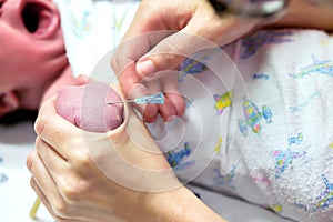 Close up of nurse hands stabbing the sick baby`s wrists to prepare the saline solution for the be severely ill newborn