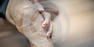 Close up of old man hand holding on the knee with suffering from knee pain. The sick legs of an old man with severely deformed