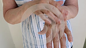 Close-up, an old woman makes herself a hand massage, arthritis, arthrosis