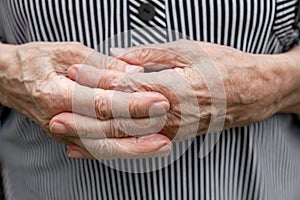 Close-up of old, wrinkled and arthritic female fingers. Hands of an elderly person