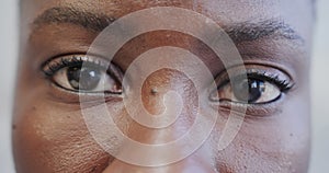 Close up of the opening eyes of african american female hospital patient, in slow motion