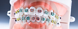 Close-up of a orthodontic model jaws and teeth with braces photo