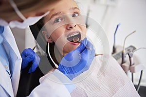 Part of orthodontist examining child`s teeth in dentist`s office photo