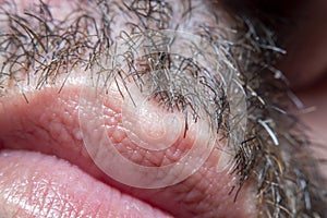 A close-up of a part of male skin with partially shaved vegetation on the face and lips with a strong magnification under a micros