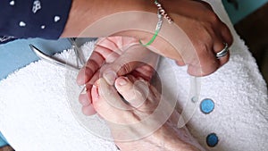 Close up of a pedicurist removing an ingrown toenail