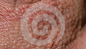 A close up of a person\'s skin with red bumps