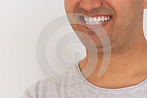 Close up photo of brown skinned young adult man with gum smiling. White teeth concept