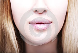 Close up photo of full woman`s lips after augmentation