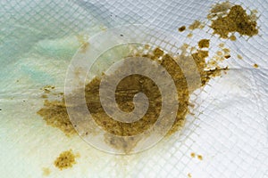 Close-up photo of a pet pad with diarrhea from a kitten with panleukopenia