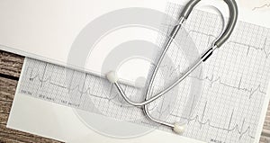 Close up photo of stethoscope and ecg test result paper