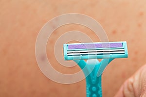 Foliculitis on hairy skin - shaving photo