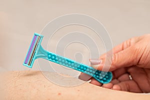 Foliculitis on hairy skin - shaving photo