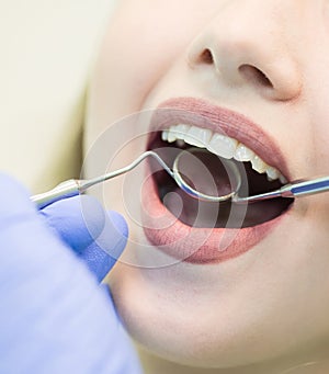 Close-up picture of young woman sitting in the dentist`s chair with opened mouth at dentist`s office while having