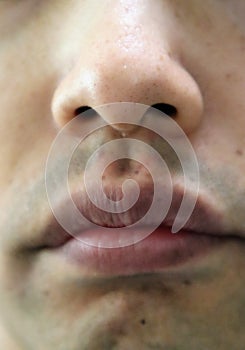 Close-up of pores on a Japanese man's nose