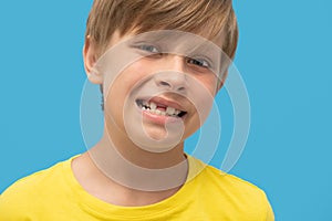 Close up portrait blond boy shows a smile without front tooth. isolated on blu background