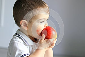 Close up portrait of cute little baby boy with atopic dermatitis on his cheek holding and eating red apple.