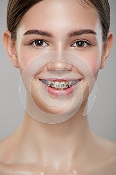 Close-up portrait cute smiling girl in braces.