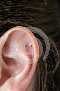 A close up portrait of the ear of a woman with acupressure ear seeds in it. The two metal balls are a form of alternative medicine