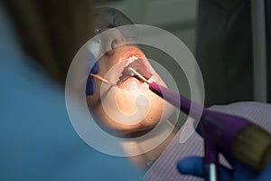 Close-up portrait of a female patient at dentist in the clinic. Beautiful girl in dental chair on the examination at