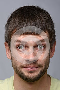 Close-up portrait of a man with bulging eyes of European appearance