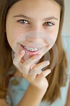 Close up portrait of smiling teenager girl showing dental braces.Isolated on white background.