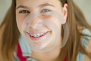 Close up portrait of smiling teenager girl showing dental braces.Isolated on white background.