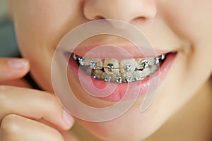 Close up portrait of smiling teenager girl showing dental braces.Isolated on white background.