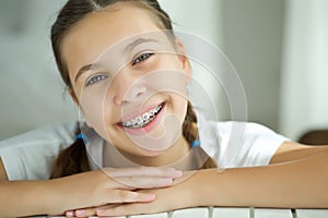 Close up portrait of smiling teenager girl showing dental braces. on white background.