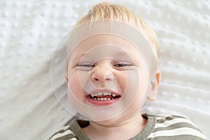 Close up portrait toddler boy smiling with caries teeth