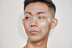 Close up portrait of young asian man with problematic skin applied cream on his face, looking aside isolated over white photo