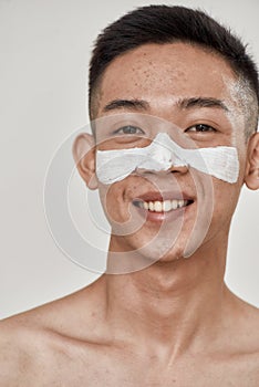 Close up portrait of young asian man with problematic skin and hyperpigmentation applied mask on his face, smiling at