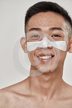 Close up portrait of young asian man with problematic skin and hyperpigmentation applied mask on his face, smiling at photo