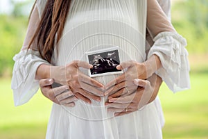 Close up of pregnant woman and her husband holding ultrasound scan on her tummy. Concept of pregnancy, expecting a baby, love,