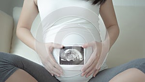 Close-up of pregnant woman holding ultrasound scan on her tummy.