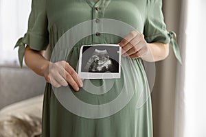 Close up of pregnant woman show ultrasound picture