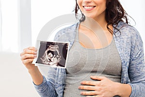 Close up of pregnant woman with ultrasound image
