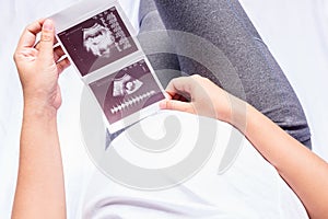 Close up pregnant women lying and holding ultrasound scan film of her baby on her bed