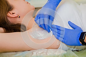 Close-up process of depilation of armpit with hot wax. Hands in blue gloves wax their hair